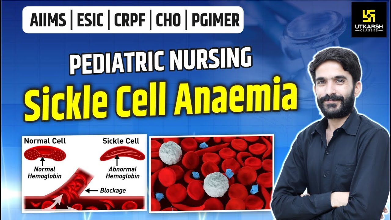 AIIMS | ESIC | CRPF | PGIMER | Sickle Cell Anaemia | Pediatric Nursing | By Raju Sir