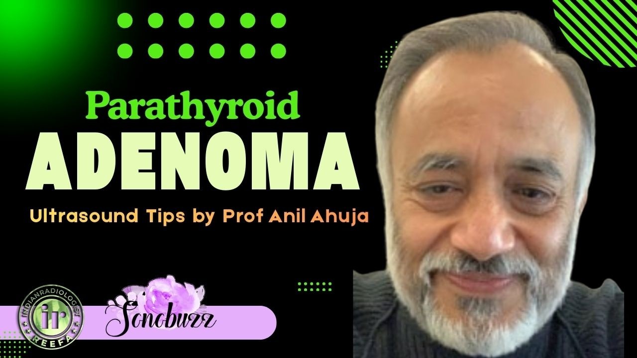 DR ANIL AHUJA | Parathyroid Adenoma - Ultrasound Tips For Accurate Detection #sonobuzz #neckimaging