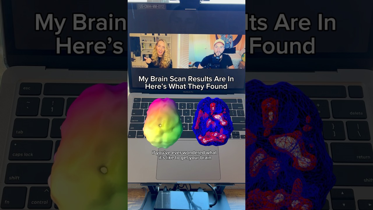 What My Brain Scan Revealed & How the Process Works