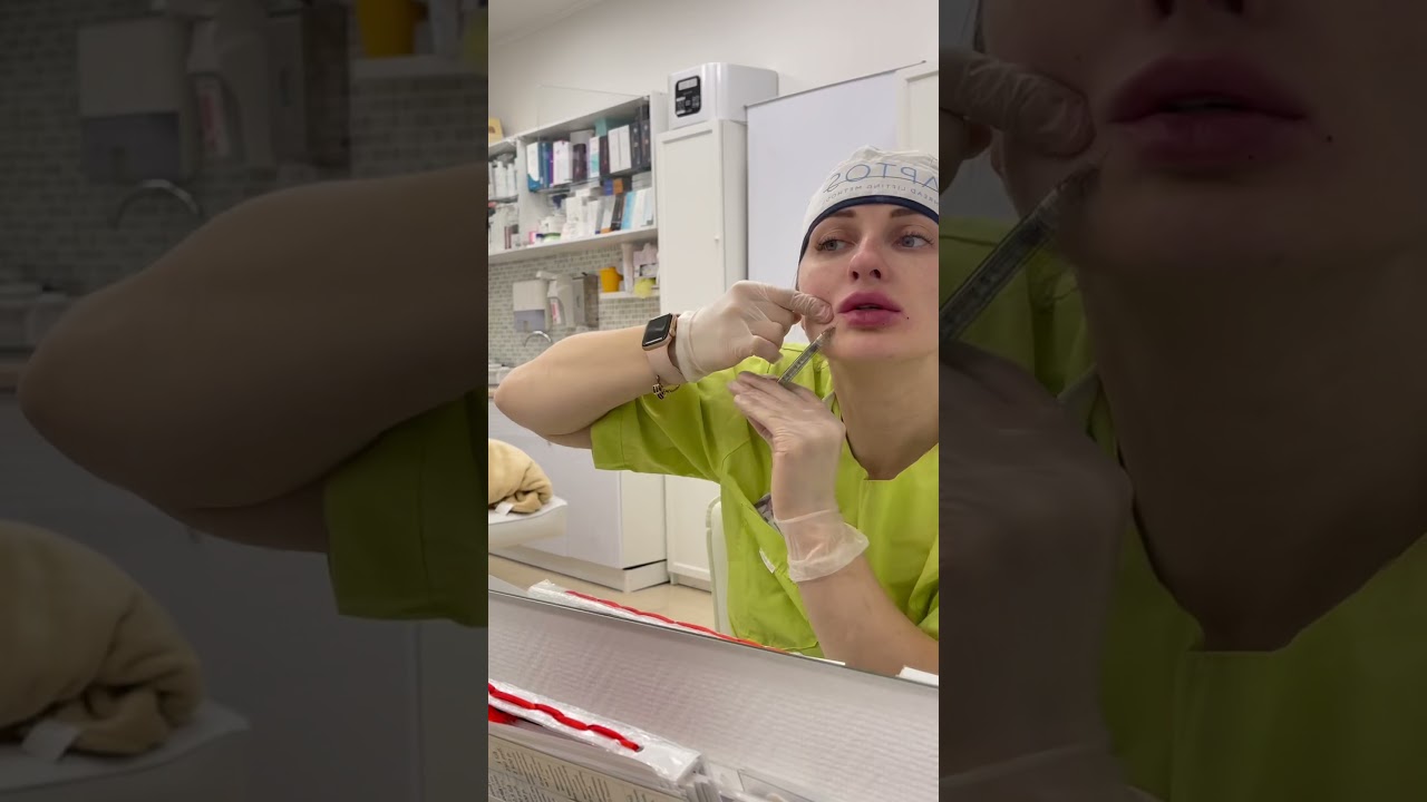Увеличение губ на себе сама врач косметолог Сосина Раиса Александровна