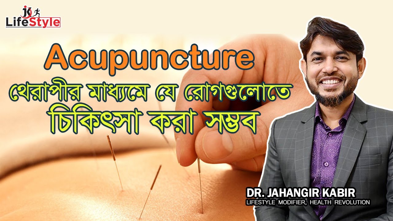 Acupuncture থেরাপীর মাধ্যমে যে রোগগুলোতে চিকিৎসা করা সম্ভব। Dr. Jahangir Kabir। JK Lifestyle