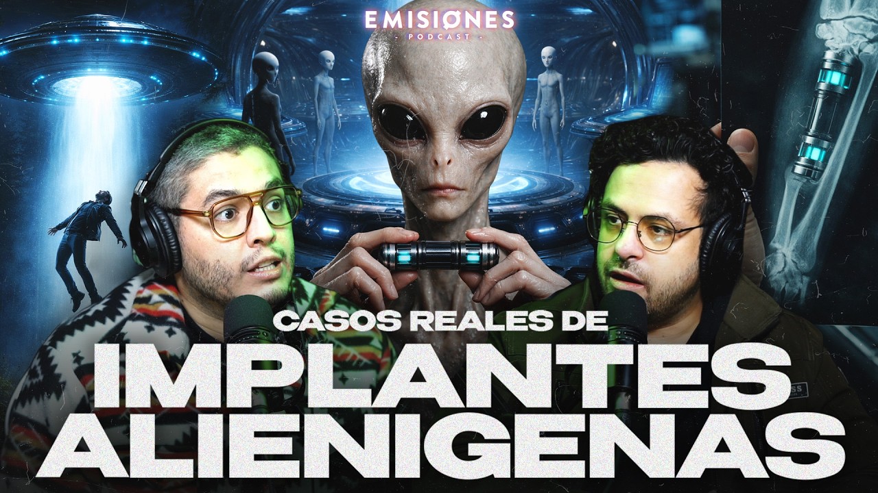 CASOS REALES de IMPLANTES ALIENÍGENAS