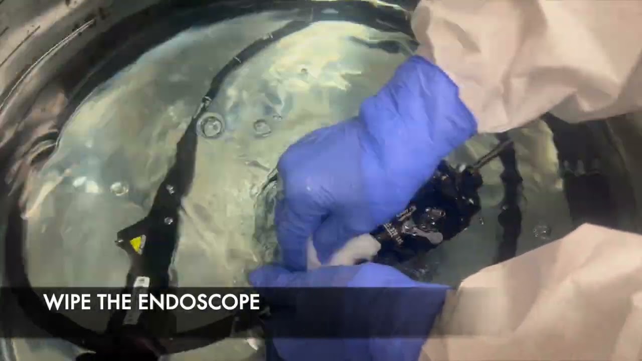 MANUAL WASHING OF ENDOSCOPE  USING SCOPE BUDDY PLUS