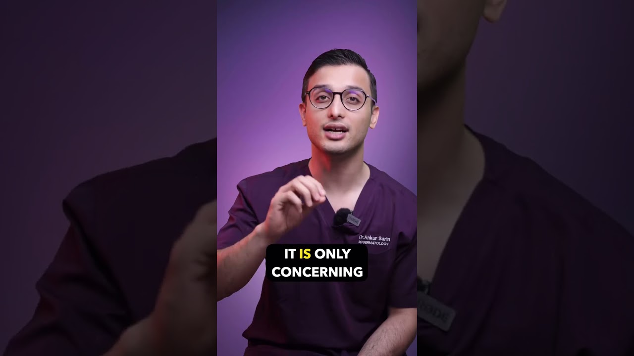 What are the reasons of cause of hair loss in male young age? | Dr.Sarin |