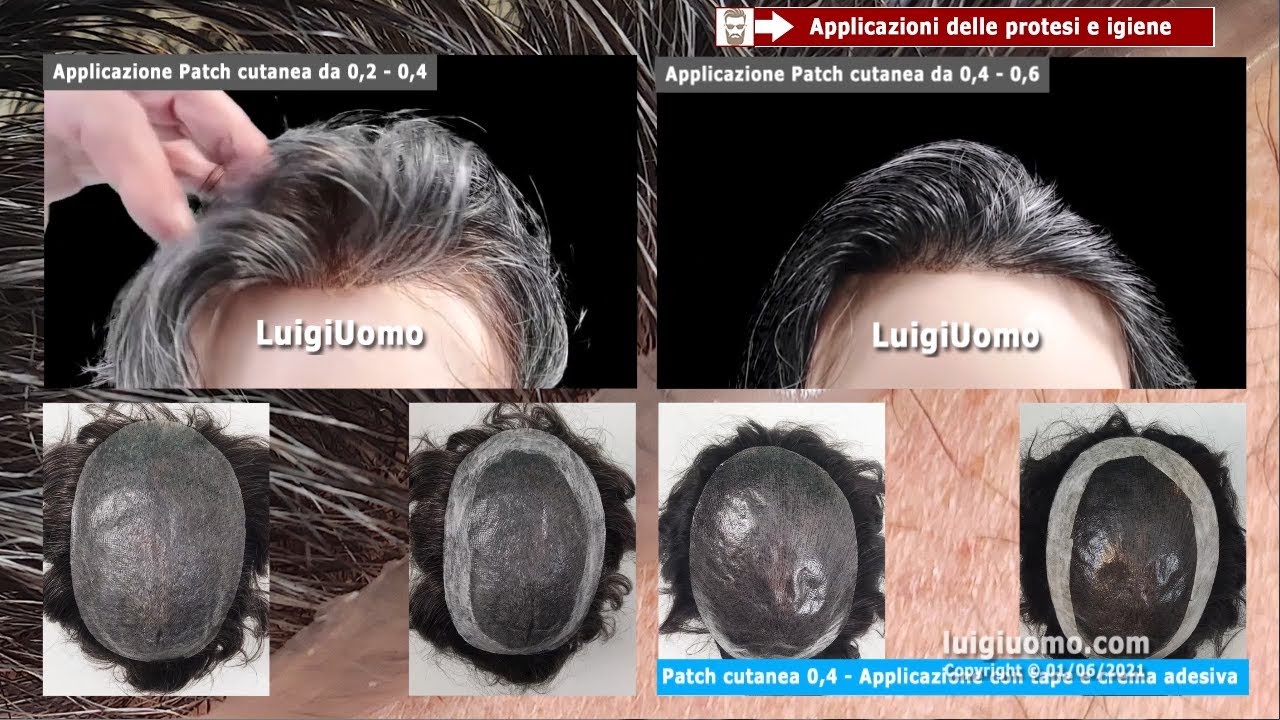 Applicazione e igiene della Patch cutanea membrana capillare protesi capelli impianti capillari
