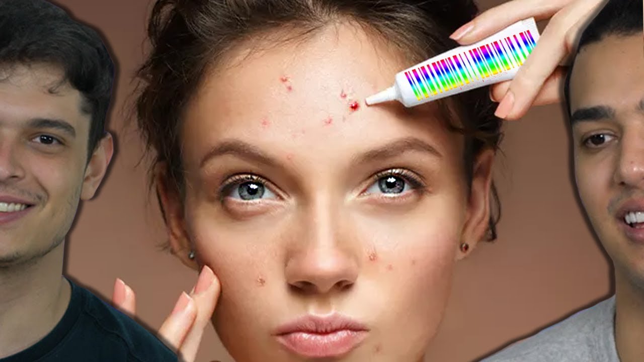 COMO ACABAR COM AS ESPINHAS/ACNE !!