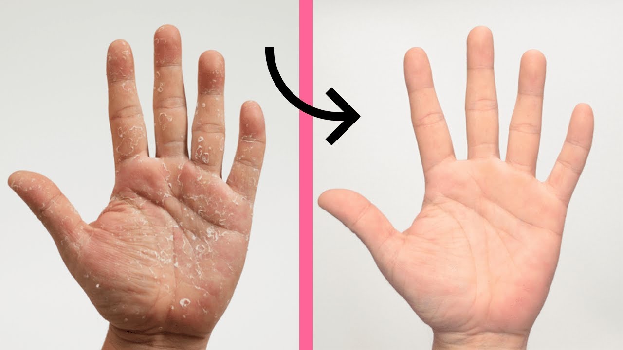 &iquest;MANOS SECAS de Tanto Lavarlas? *Mascarilla Para manos Secas y &aacute;speras*