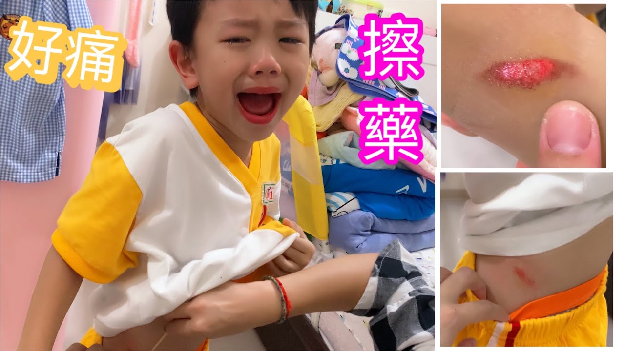 ［擦傷］學校摔倒 看了就好痛 滾妹秀秀安慰 媽媽幫你擦藥藥［滾哥滾妹的遊樂世界］