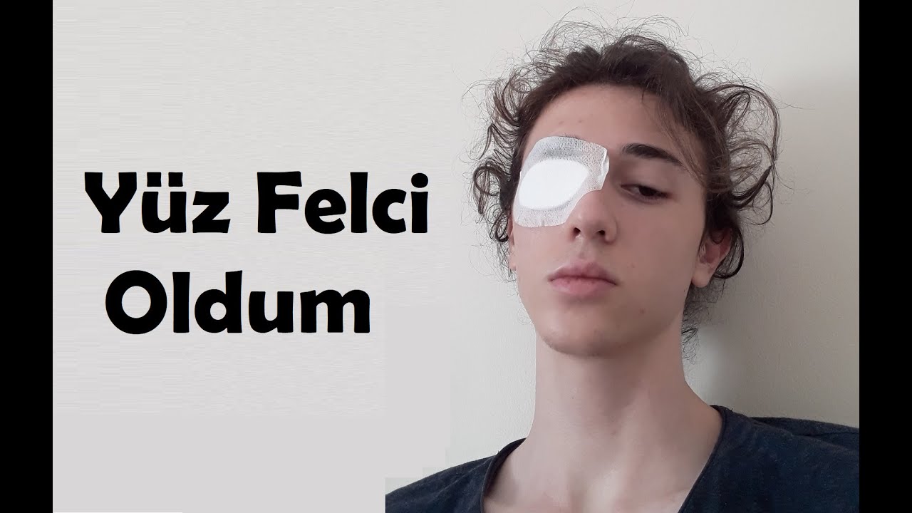 Yüz Felci (Facial Paralysis)