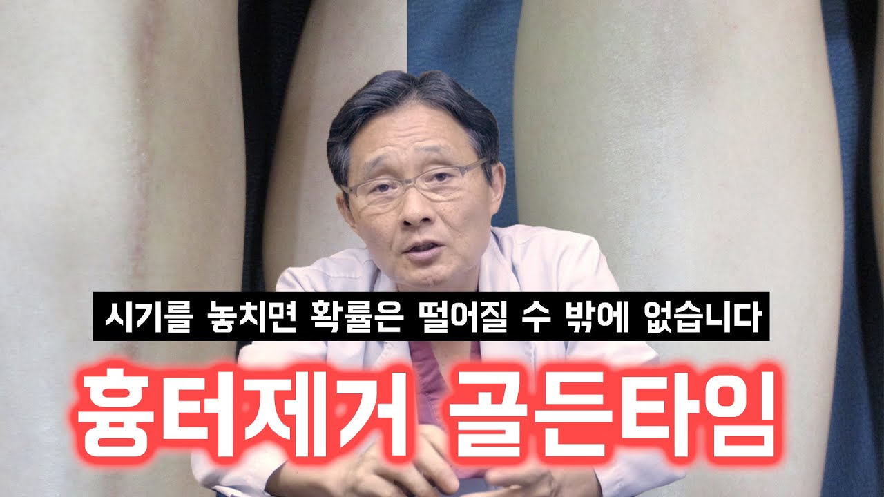 어디서도 들을 수 없는 35년 동안 흉터치료를 해온 성형외과의가 말하는 적절한 치료시기