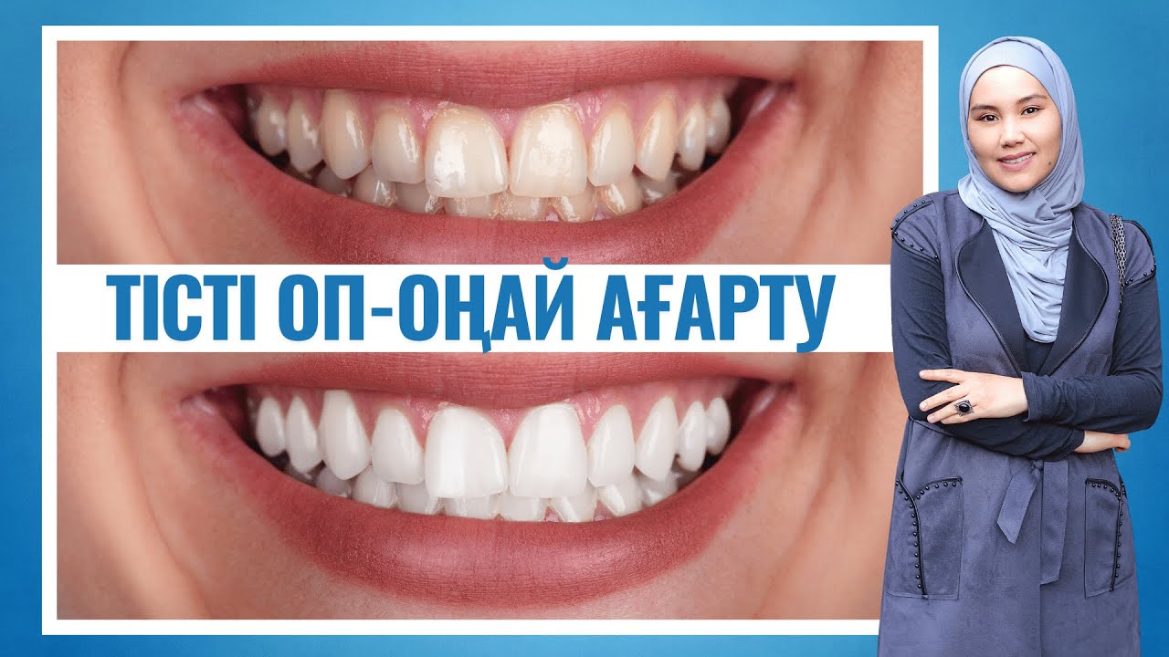 Үй жағдайында тісті ағарту оңай жолдары Мика Ханым