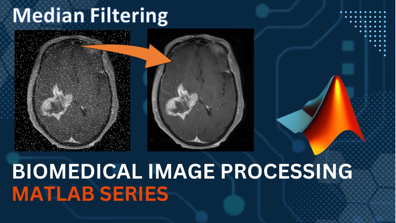 Median Filter || MATLAB Code Implementation || Medical Image Processing |Computer Vision