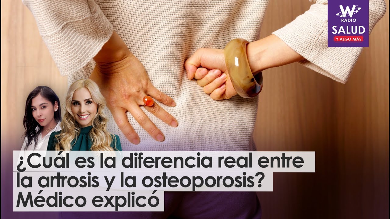 ¿Cuál es la diferencia real entre la artrosis y la osteoporosis? Médico explicó | Salud y Algo Más