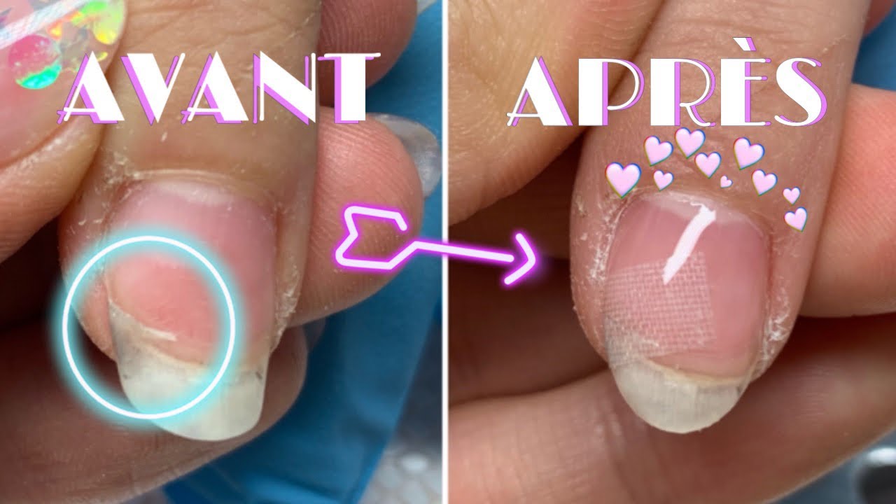 TUTO NAILS ⎥  Comment réparer un ongle fissuré? ⛑