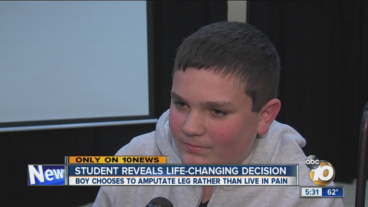 North County boy chooses amputation of leg over wheelchair and lifetime of pain