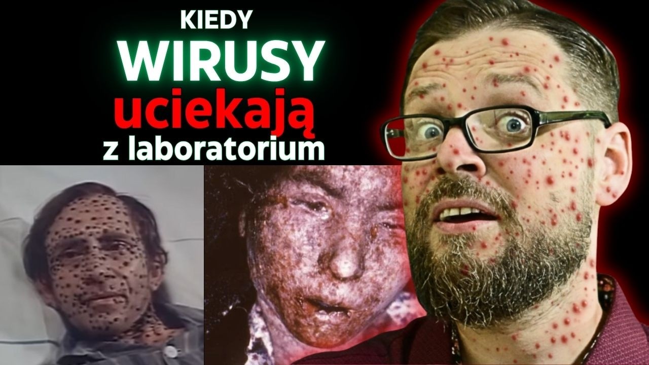 Prawdziwe katastrofy biologiczne. Wycieki, celowe działania i głupota!