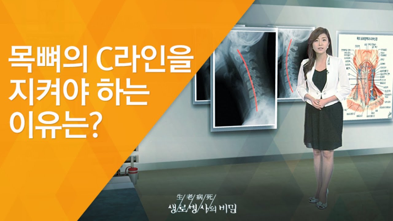 목뼈의 C라인을 지켜야 하는 이유는? - (2009.10.22_383회 방송)_일자목의 경고 경추, C라인을 지켜라!