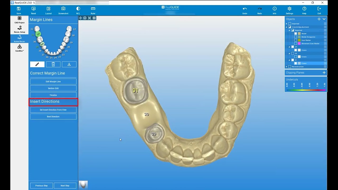 RealGUIDE Software:  Reconstruction Setup- Part 4