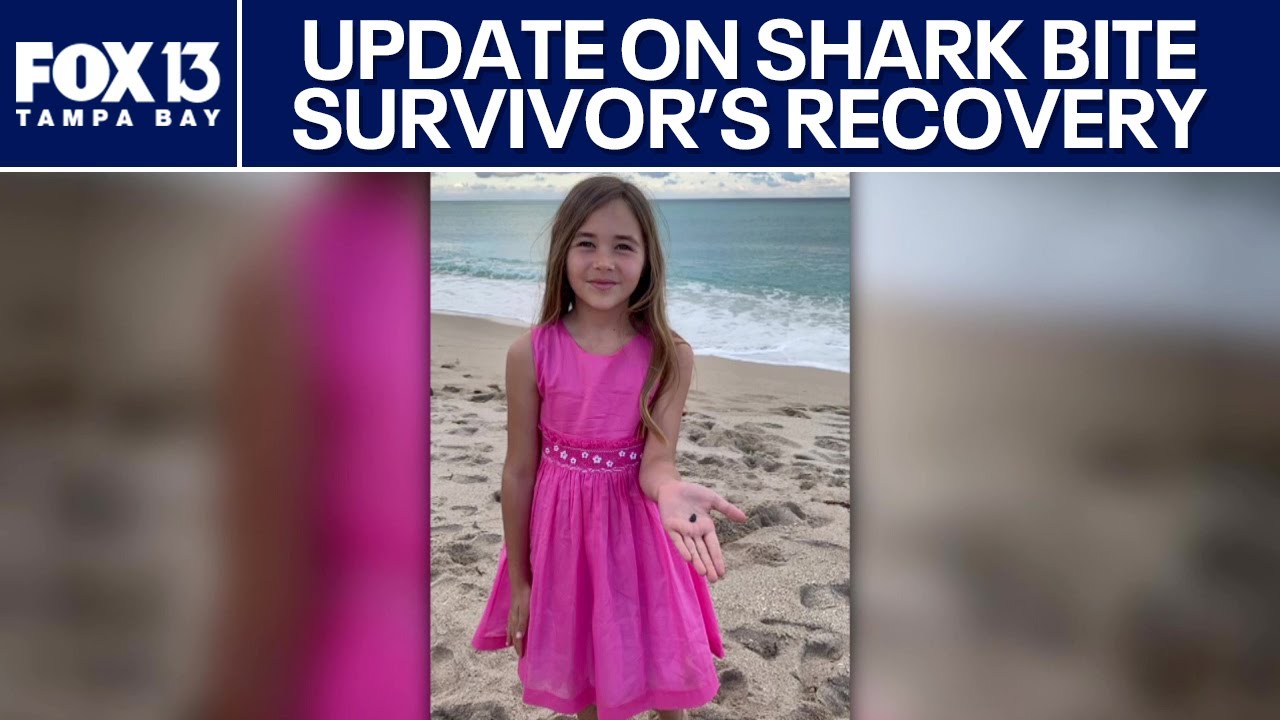 Live: Florida shark bite survivor recovering in Tampa