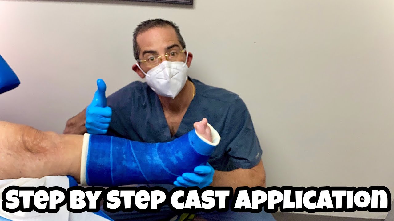 EVER WONDER HOW WE APPLY A CAST??