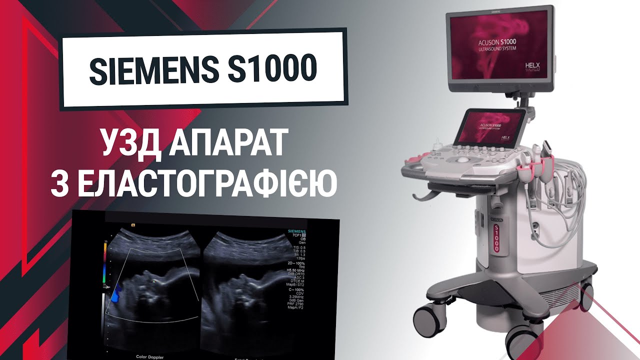 Відеоогляд УЗД апарату Siemens S1000