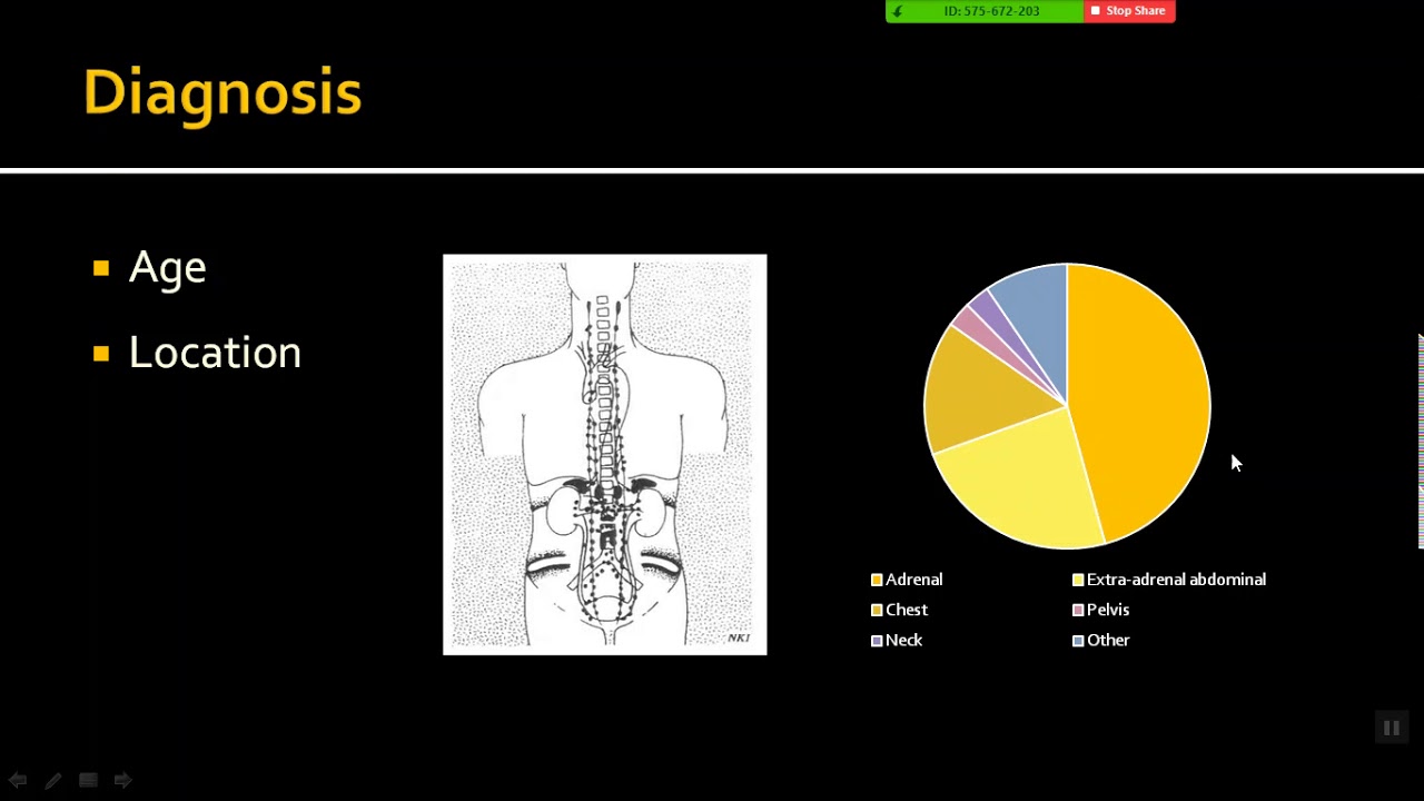 Imaging of Neuroblastoma
