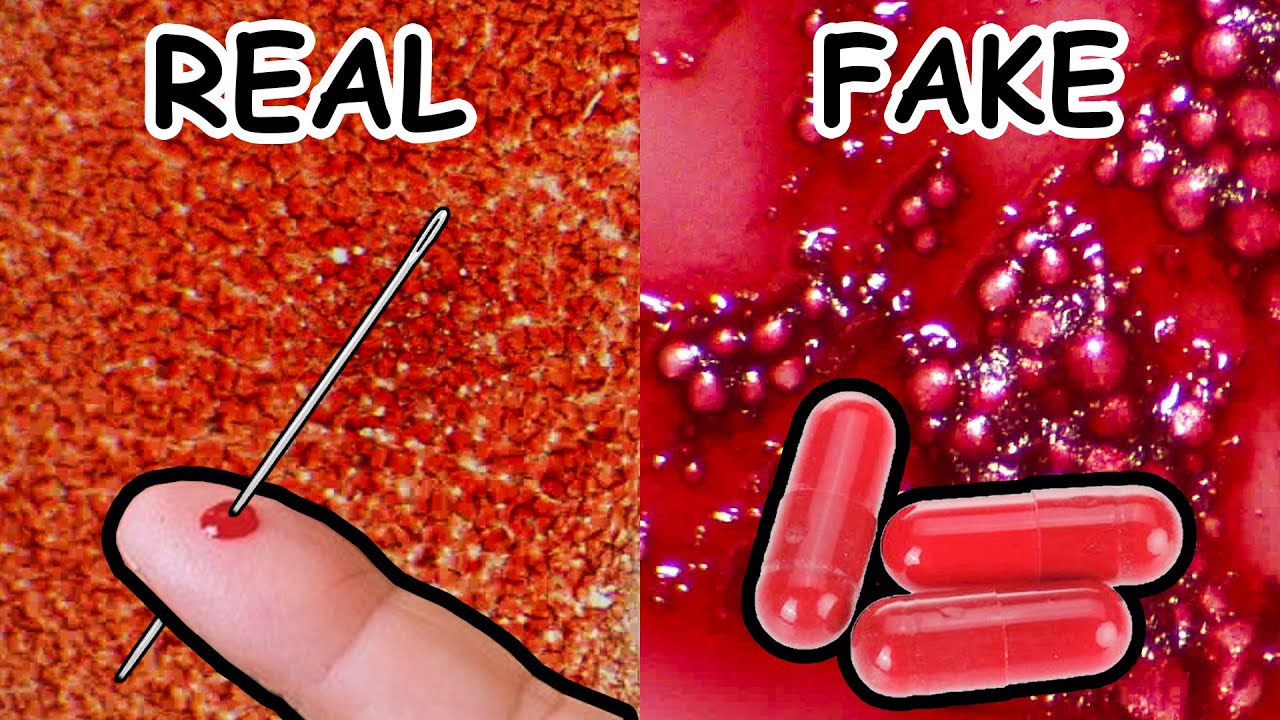 Real Blood vs. Fake Blood Under Microscope! Can You Spot The Difference?
