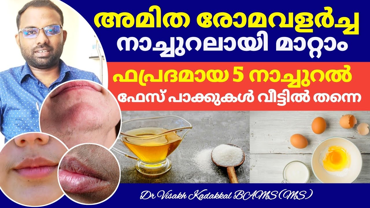 Top 5 Hair Removal Tips at Home | അമിത രോമവളർച്ചക്ക് 