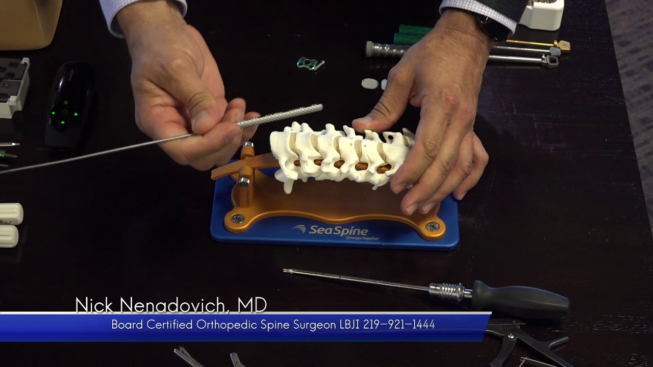 Nick Nenadovich Anterior Cervical Fusion VS  Disc Replacement 5 11 18