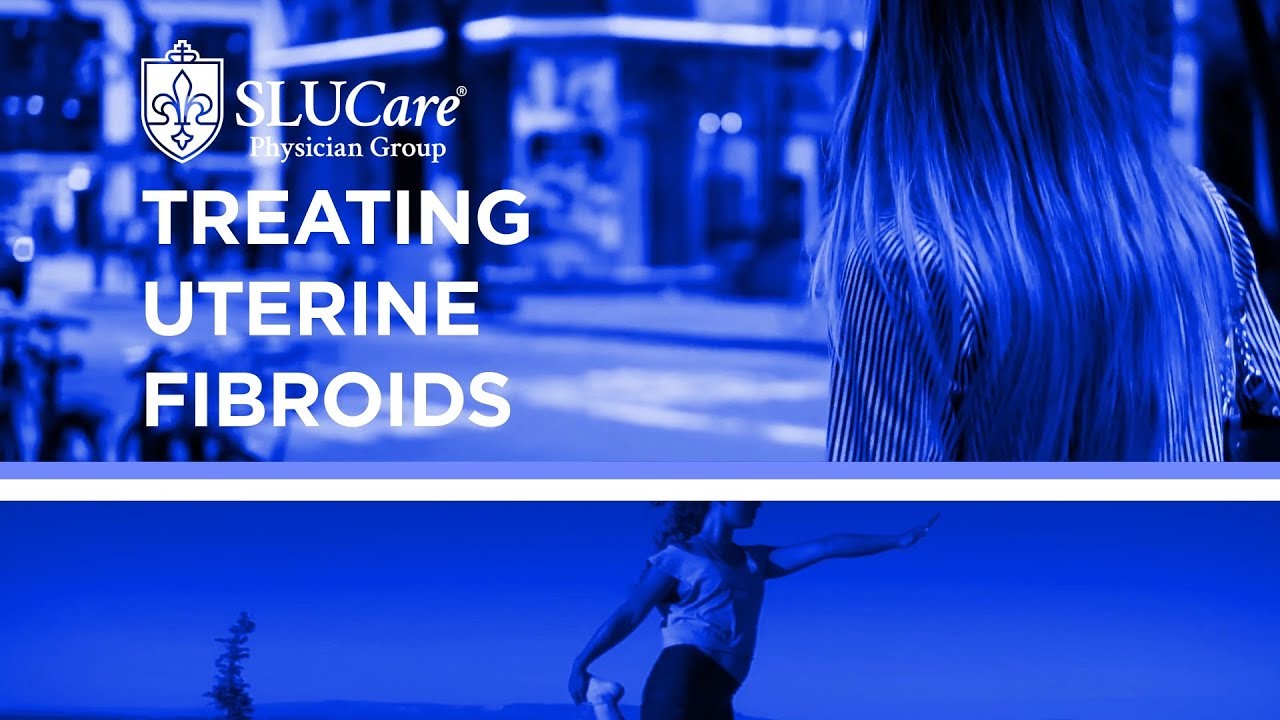 Treat Uterine Fibroids with Minimally Invasive Gynecological Surgery - SLUCare OB/GYN