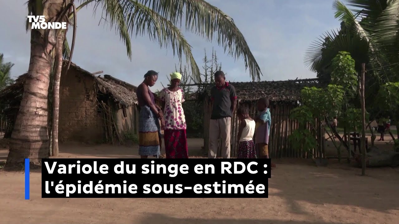 Variole du singe en RDC : l'épidémie sous-estimée