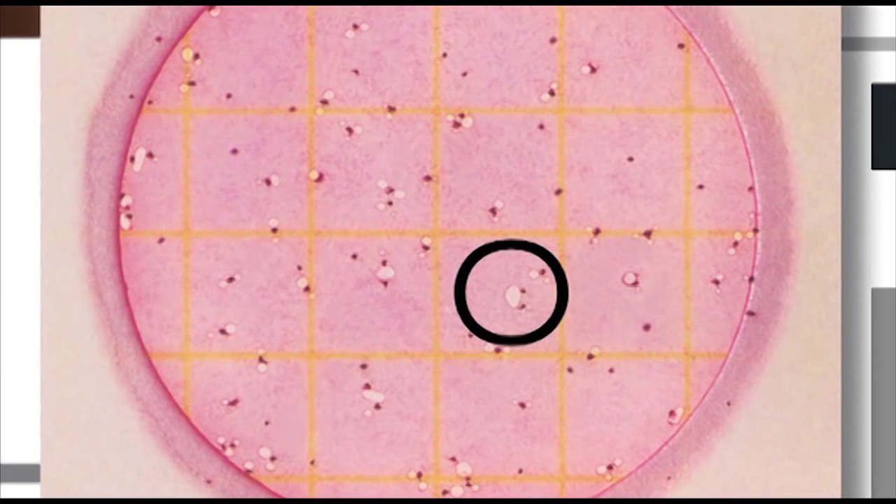 3M™ Petrifilm™ Plates   Coliform