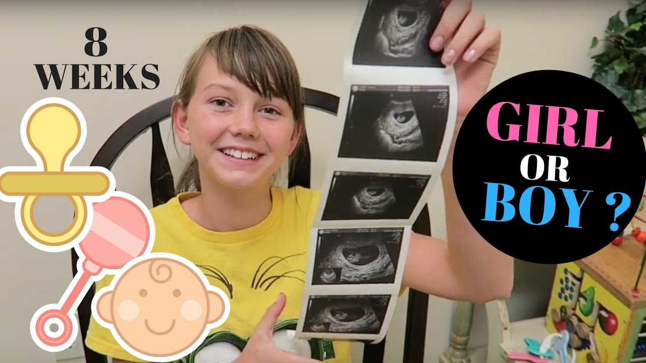 First Ultrasound 8 weeks Boy Or Girl?