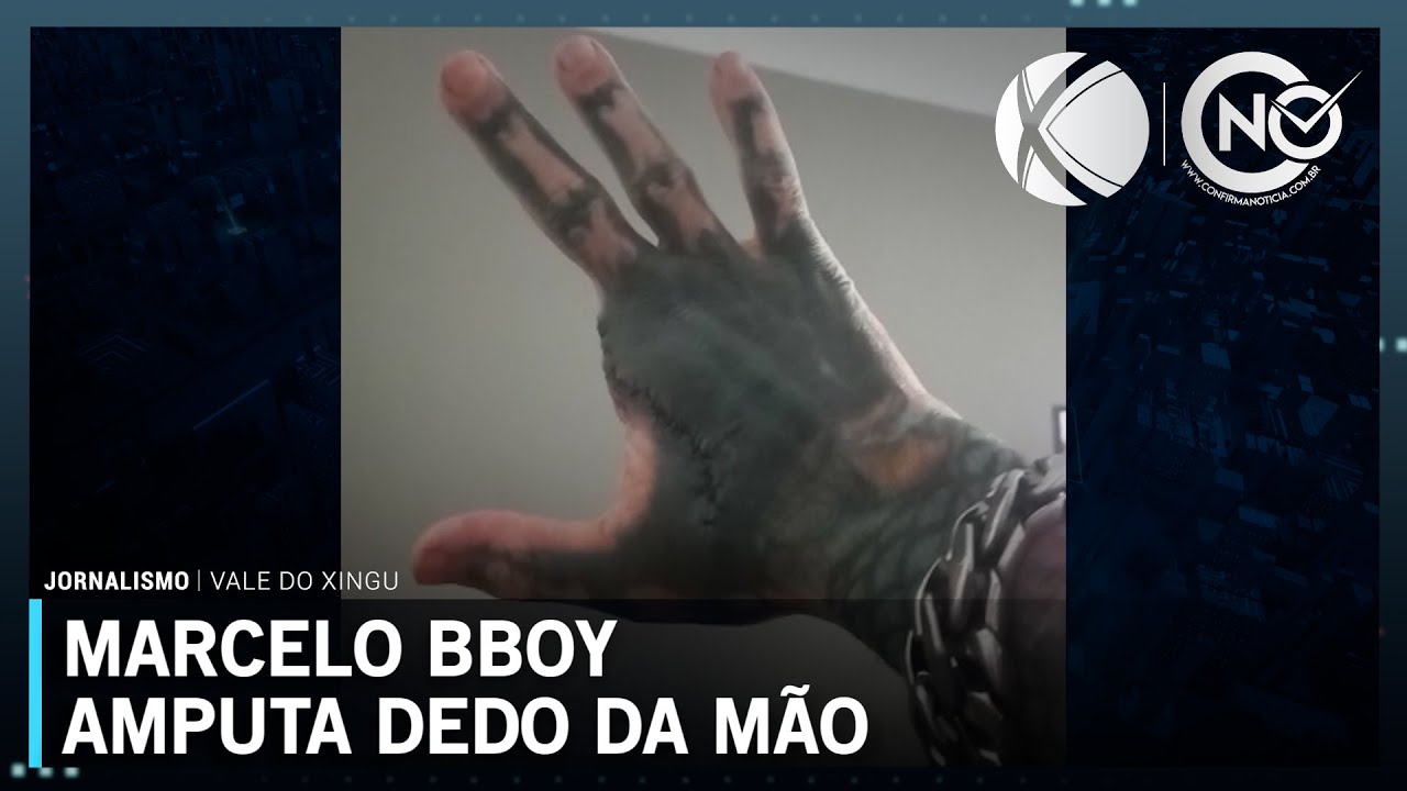 Tatuador brasileiro amputa dedo da mão em mais uma modificação corporal | SBT Altamira