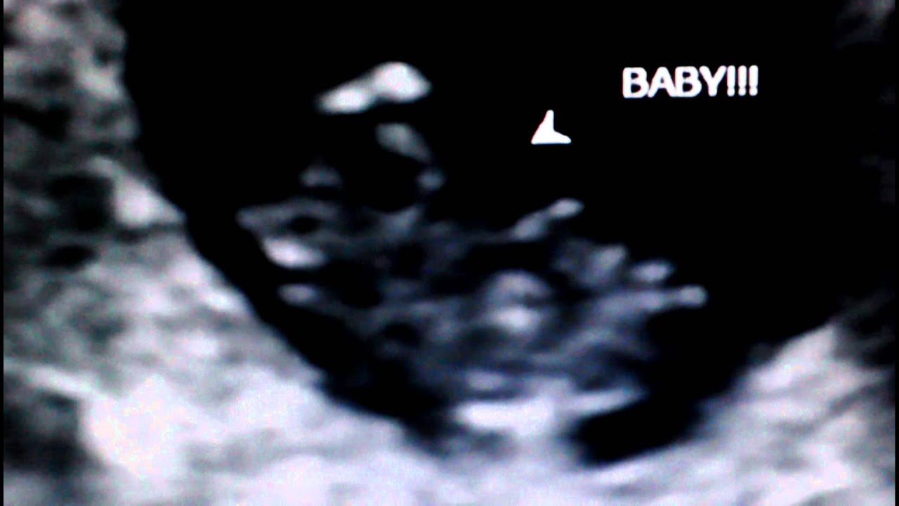 Heartbeat of Lucius Alexander