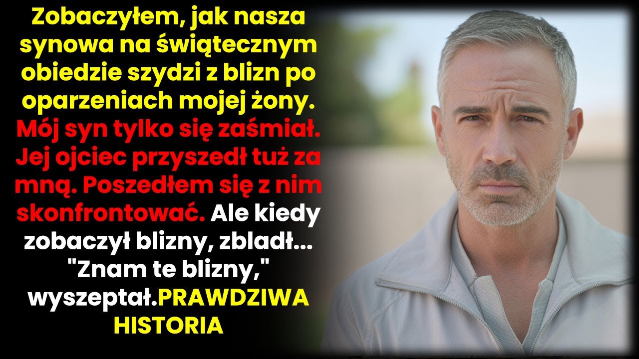 Synowa wyśmiała blizny żony, dopóki jej ojciec ich nie zobaczył... i zamarł z wrażenia.