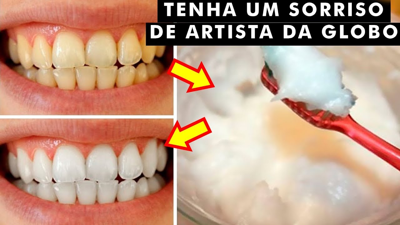6 maneiras de CLAREAR os DENTES naturalmente
