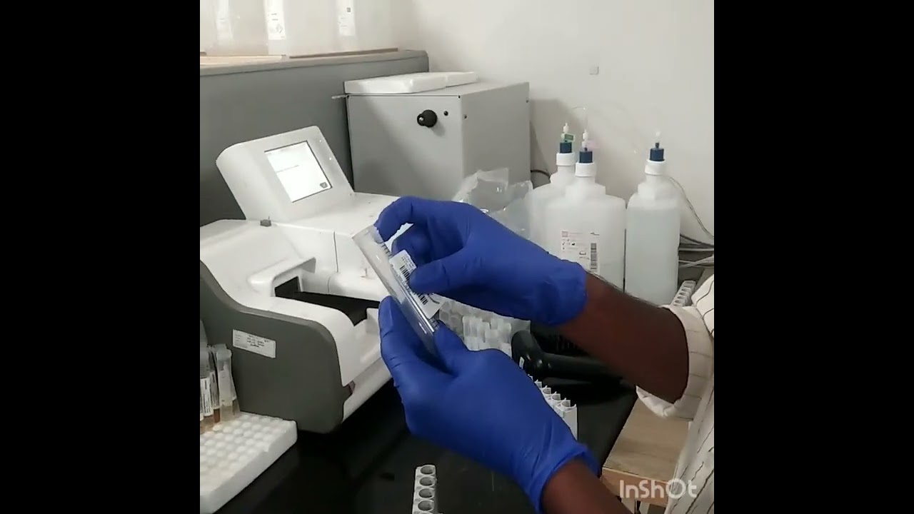 ಹೇಗೆ urine routine test process ಮಾಡುತರೆ 
