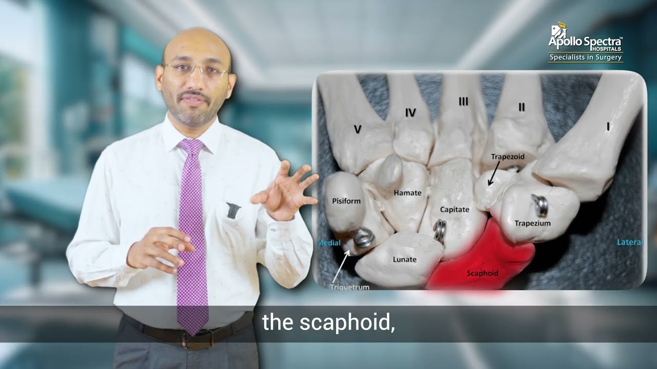 Scaphoid Fracture - A brief overview by Dr. Darshan Jain
