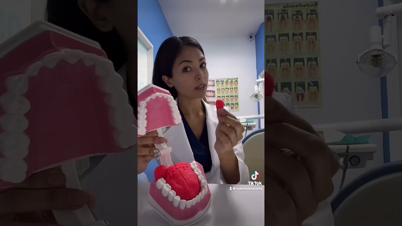 ¿Qué hacer con el caseum, los tonsilolitos o cálculos amigdalinos?