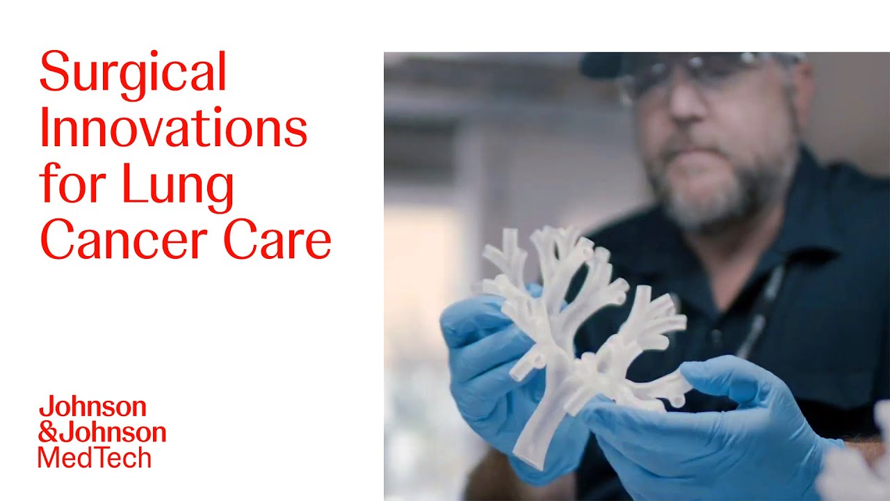 Advancing Solutions for Lung Cancer Care | Lung Cancer Awareness Month | J&J MedTech