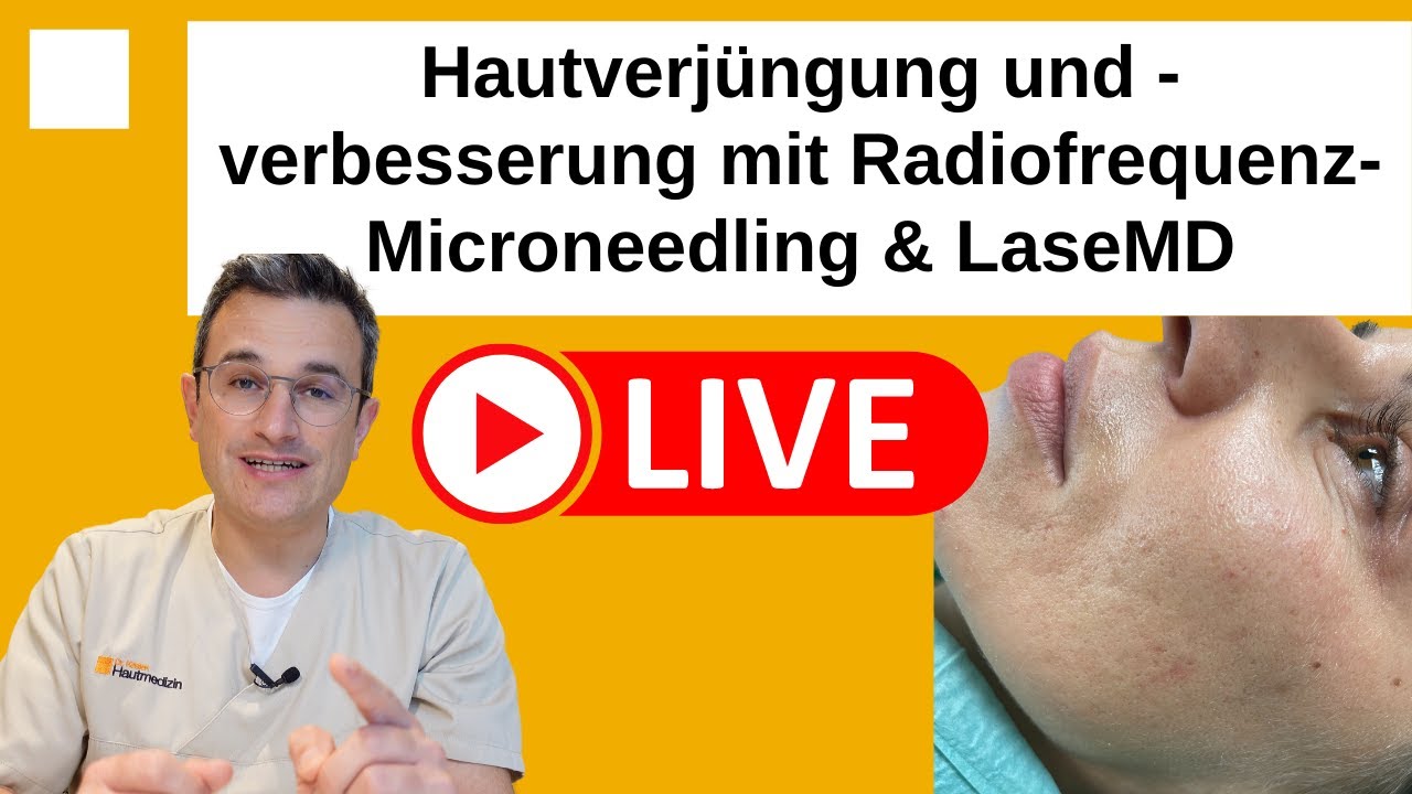 Hautverjüngung mit Radiofrequenz-Mikroneedling: Hautbild verbessern, jünger & frischer aussehen