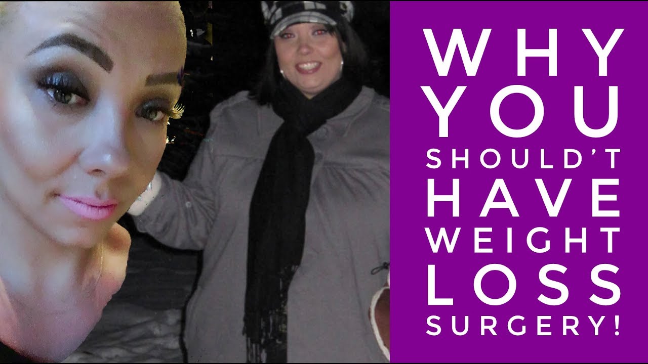 Why YOU Shouldn't have Weight Loss Surgery! - The Truth!