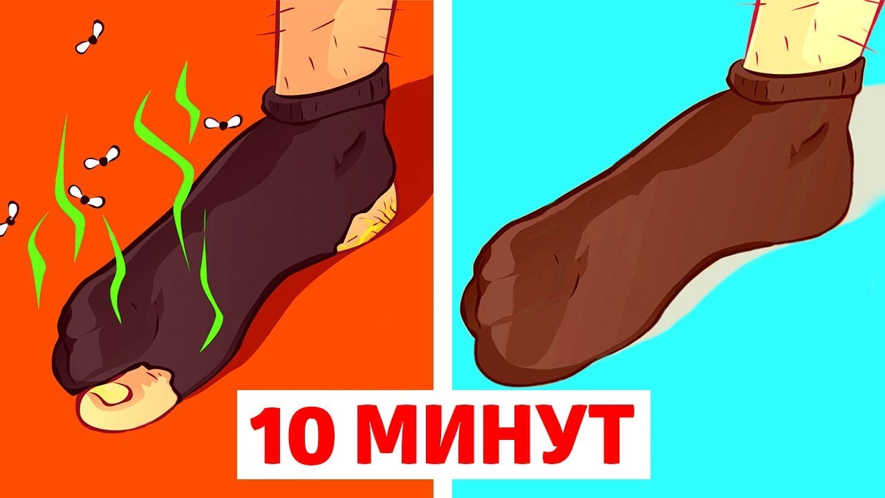 ИЗБАВЬТЕСЬ ОТ ЗАПАХА ПОТНЫХ НОГ РАЗ И НАВСЕГДА!