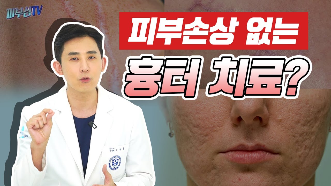 피부 손상없는 흉터 치료를 아시나요? [피부과전문의 피부심]