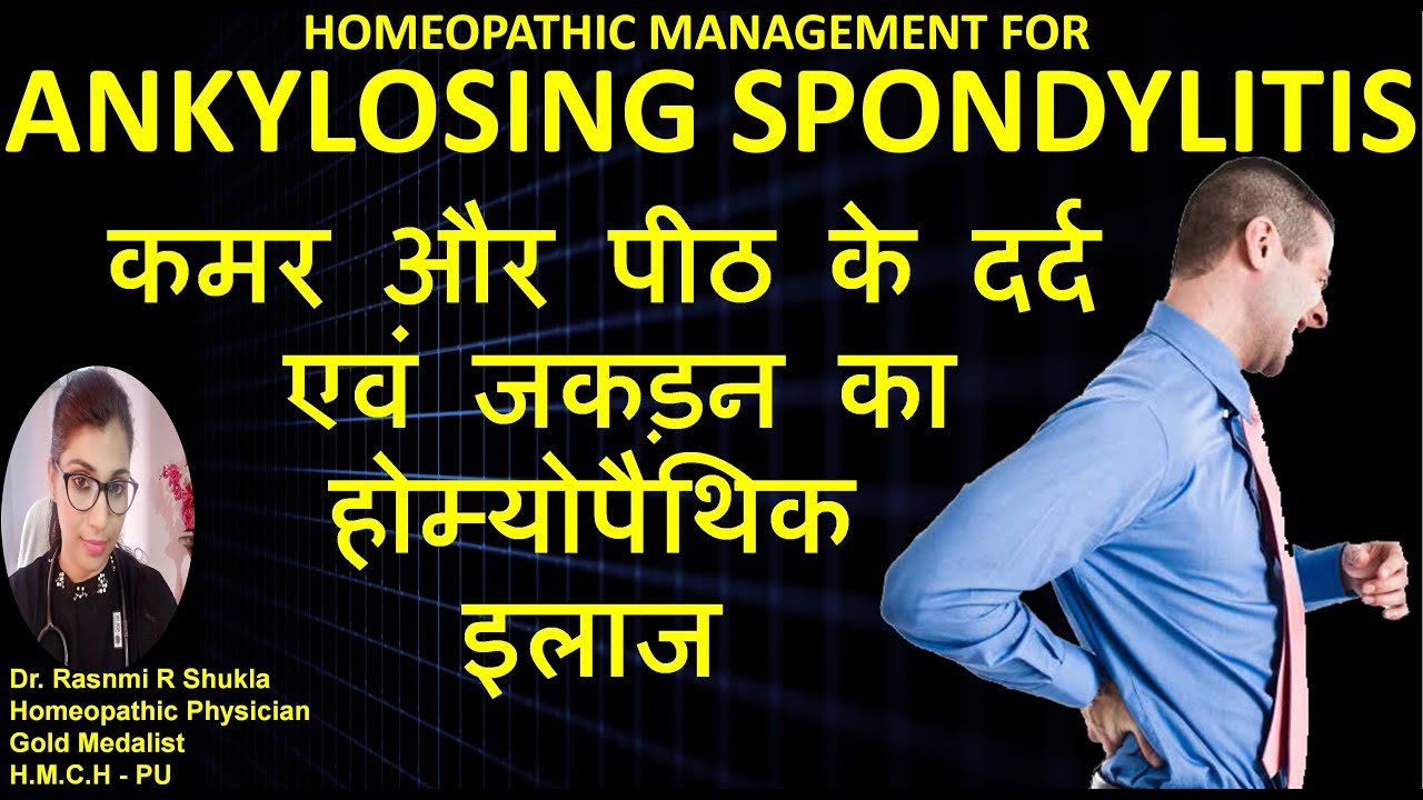 Ankylosing spondylitis :Causes Symptoms and Treatment