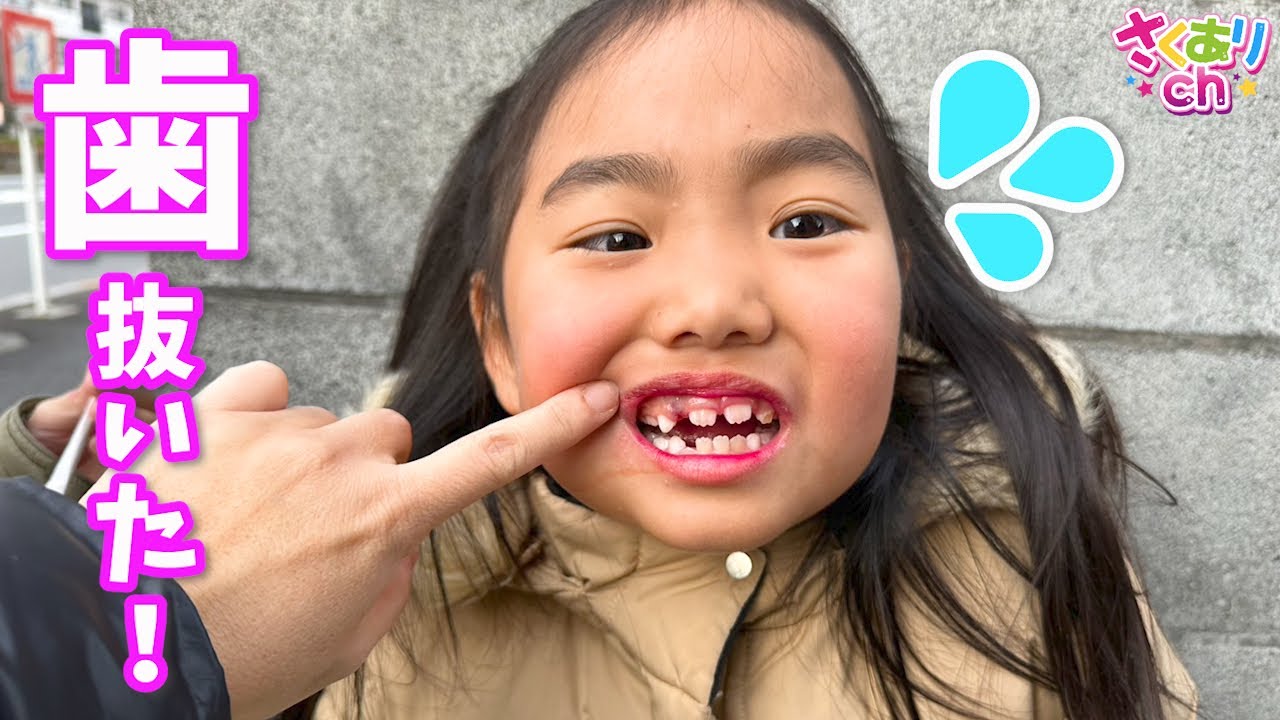 【病院】久しぶりに歯医者さんへ行ったらまさかの歯を抜くことに😭しかも抜いた歯が無くなった⁉️ママも虫歯で歯が痛い&hellip;大変