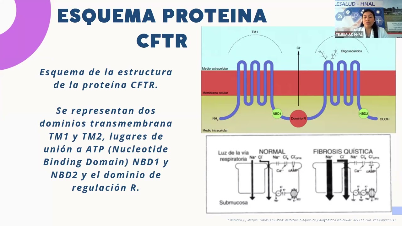 TELECAPACITACIÓN ¿CUANDO SOSPECHAR DE UNA FIBROSIS  QUISTICA EN PEDIATRIA   MC  CORTIJO CARLA ALFARO