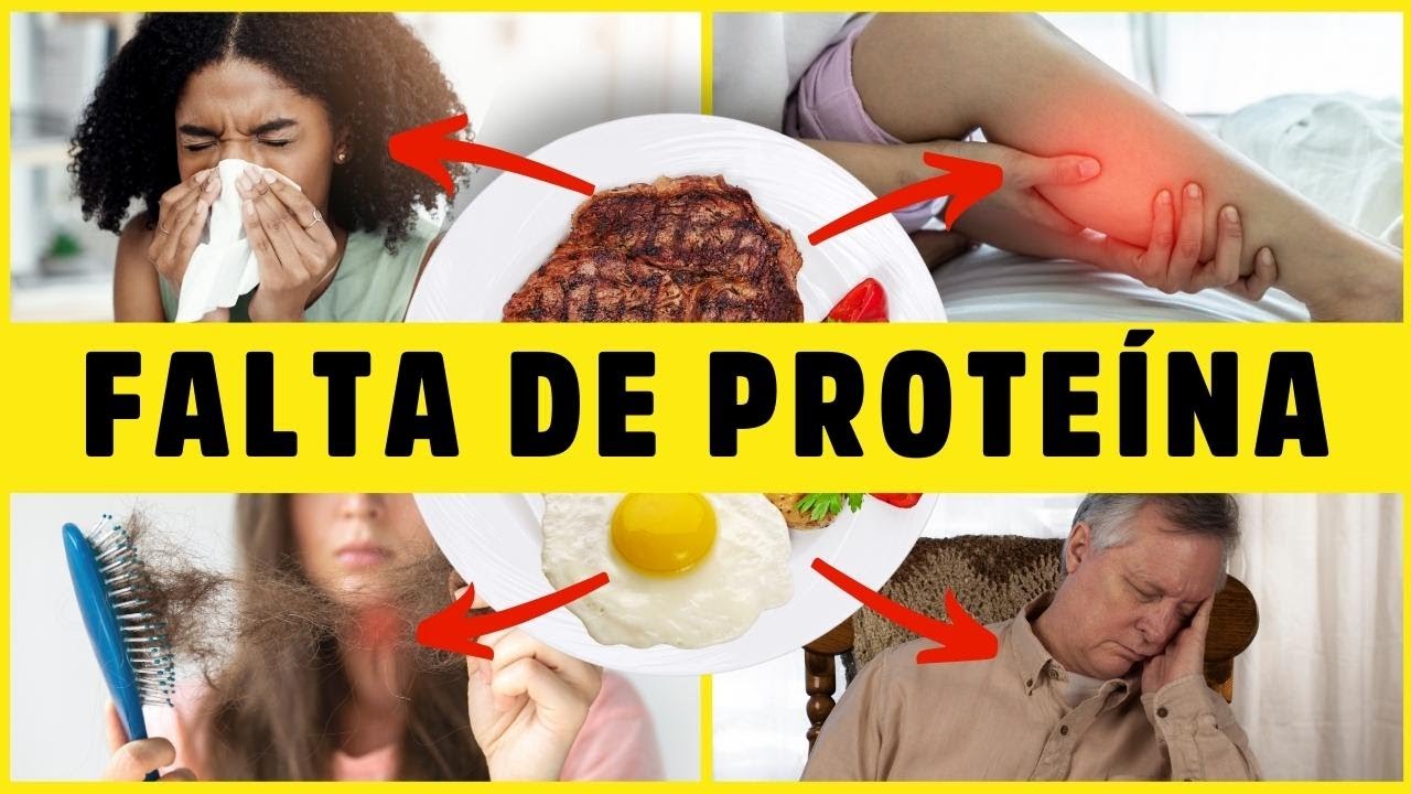 11 SINAIS de FALTA DE PROTEÍNA que VOCÊ NUNCA Imaginou! (Podem Arruinar sua Saúde) Dr Alain Dutra