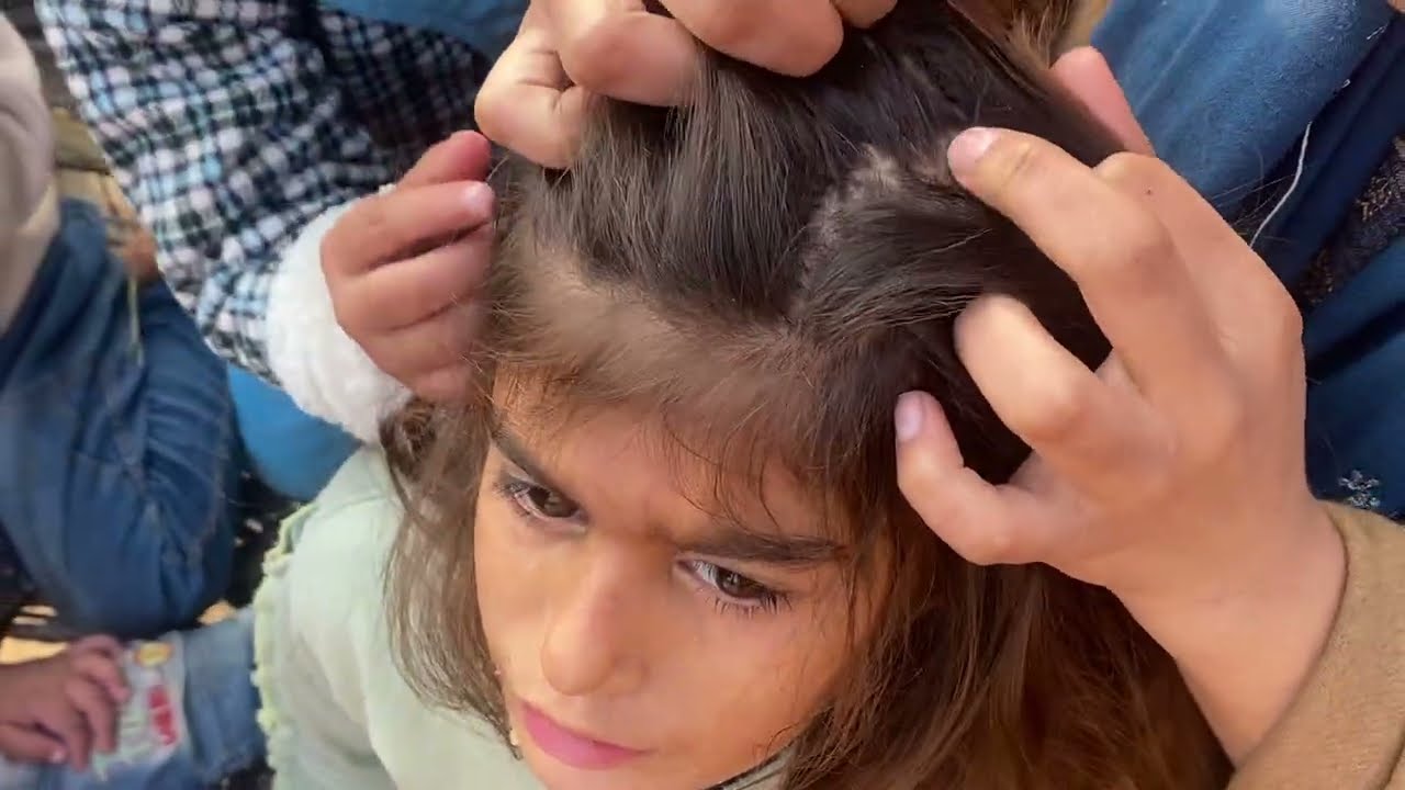 | @LaibaButt-b8t | Nits piking by Nenu and Elma |#haircareroutine |#headlice |#ivreashampo |